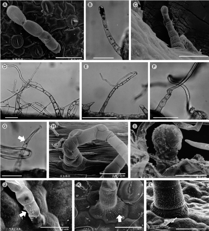 Tricomas en Senecio L. sección Mulgediifolii Greenm. A. Subtipo 2a1, sin ornamentación y cera ausente, S. jacalensis Greenm., superficie adaxial. B. Tipo 2b, S. conzatti Greenm. margen. C. Subtipo 2b1, papilas y estrías, S. runcinatus Less., margen. D. Tipo 2f, S. mulgediifolius S. Schauer, superficie abaxial. E. Tipo 2g, S. mulgediifolius S. Schauer, superficie abaxial. F. Tipo 2h, S. bracteatus Klatt. G. Tipo 2h, punteaduras como placa de perforación (flecha), S. bracteatus Klatt. H. Tipo 3d, S. polypodioides (Greene) T. Durand & B.D. Jacks., superficie abaxial. I. Tipo 4a, S. roseus Sch. Bip., margen. J. Cera en costras (flecha), S. madrensis A. Gray, superficie abaxial. K. Pliegues en campo anticlinal y papilas en célula epidérmica (flecha), tricoma con papilas convexas, S. iodantus Greenm., superficie abaxial. L. Pliegues en campo anticlinal y papilas en célula epidérmica, con las papilas dispuestas como estrías, S. runcinatus Less., superficie abaxial. Escalas: A: 50 µm; C: 100 µm; B, D, F, G: 10 µm; E: 30 µm; H: 200 µm; I-L: 40 µm.