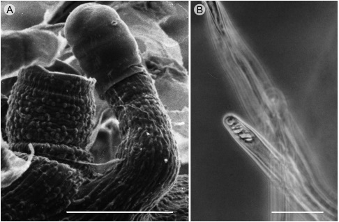 Detalles de tricomas en Senecio L. sección Mulgediifolii Greenm. A. Papilas y estrías en la base del subtipo 2b1, S. runcinatus Less., margen. B. Tipo 2h, pared de unión oblicua y punteada como placa de perforación, S. bracteatus Klatt, superficie abaxial. Escalas: A: 50 µm; B: 5 µm.