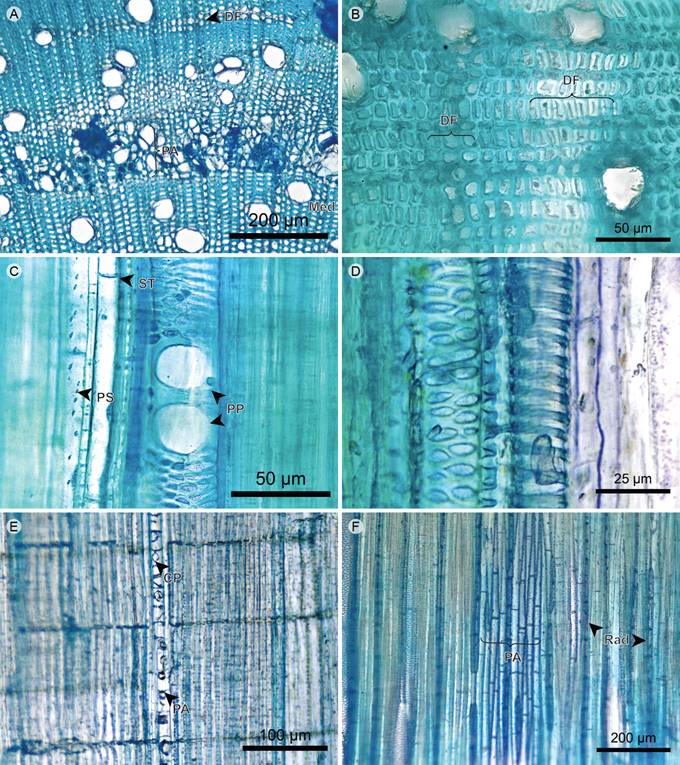 Hemiepiphyte: Xylem. A. xylem of Blakea watsonii (Cogn.) Penneys & Almeda; B. xylem of Blakea rosea (Ruiz & Pav.) D. Don.; C. xylem in tangential section of Blakea watsonii (Cogn.) Penneys & Almeda; D. protoxylem in radial section of Blakea watsonii Cogn.; E. xylem in radial section of Blakea rosea (Ruiz & Pav.) D. Don.; F. xylem in tangential section of Blakea watsonii (Cogn.) Penneys & Almeda (CP, prismatic crystal; DF, fiber dimorphism; PA, axial parenchyma; PP, perforation plate; PS, fiber simple pit; Rad, ray; ST, fiber transversal septum).