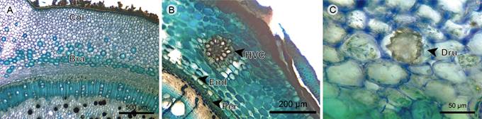 Trees/shrubs: Cortex. A. transverse section of Graffenrieda emarginata (Ruiz & Pav.) Triana; B. cortex of Tibouchina lepidota (Bonpl.) Baill.; C. cortex of Meriania nobilis Triana. (Bra, stone cell; Col, angular collenchyma; Dru, druse; End, endodermis; HVC, cortical vascular bundle; Per, pericycle).