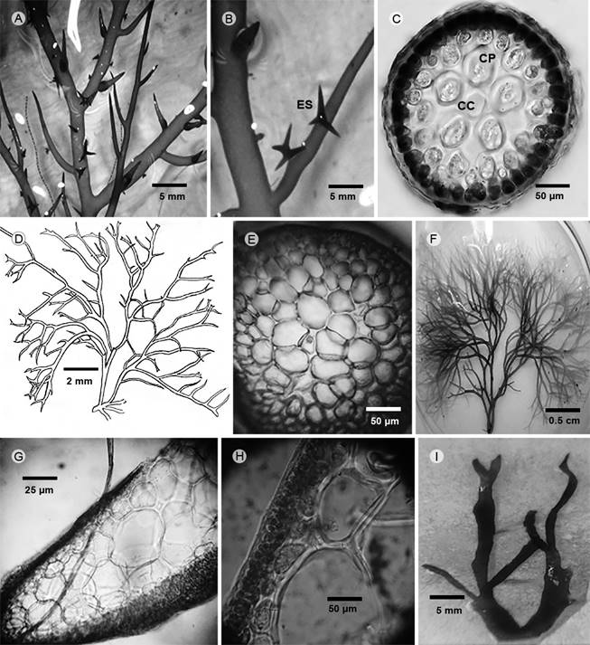 A-C. Hypnea valentiae (Turner) Montagne: A. aspecto del talo; B. detalle del talo con ramas con forma de estrella (ES); C. corte transversal, c&eacute;lula central (CC) y c&eacute;lulas pericentrales (CP). D, E. Gracilaria tikvahiae McLachlan: D. aspecto del talo; E. corte transversal. F. Gracilaria venezuelensis W.R. Taylor: aspecto del talo. G-I. Rhodymenia pseudopalmata (J.V. Lamouroux) P.C. Silva: G. corte transversal; H. detalle del corte transversal, se observan c&eacute;lulas medulares; I. aspecto del talo.