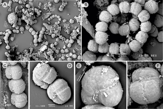 Gymnodinium catenatum Graham (SEM)
										(Gc). A. image of a bloom, showing solitary
									cells and in chains of up to eight cells; B. spiral chain of 14
									cells, dorsal view; C. chain of four cells, latero-ventral view;
									D. chain of two cells, latero-ventral view; E-F. apical cells,
									ventral view. Scales: A=100 &micro;m; B=20 &micro;m; C, D, E=10 &micro;m;
									F=5&micro;m