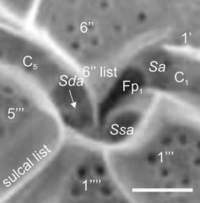 Pyrodinium bahamense var.
										compressum (B&ouml;hm) Steidinger, Tester et
									Taylor (SEM). Amplification of the ventral region of the cell
									evidencing three sulcal plates; Sa=Anterior
									sulcal plate, Sda=Right accesory sulcal plate
									(white arrow); Ssa=Left accessory sulcal plate,
									Fp1=Flagelar pore 1, C=Cingular plates; (&lsquo;)=Apical plates;
									(&lsquo;&rsquo;)=Precingular plates; (&lsquo;&rsquo;&rsquo;)=Postcingular plates;
									(&lsquo;&rsquo;&rsquo;&rsquo;)=Antapical plates. Mertens et al. (2015) was followed for the
									appointment of sulcal plates. Scale bar=5 &micro;m
