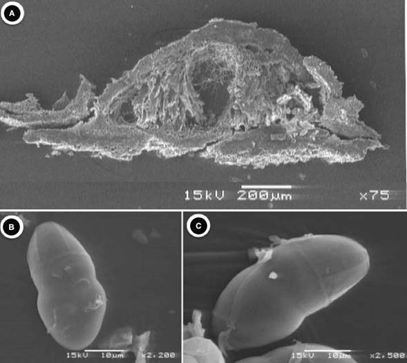 Macrovalsaria megalospora (Mont.) Sivan. A.
							pseudotecios en MEB; B-C. ascosoporas