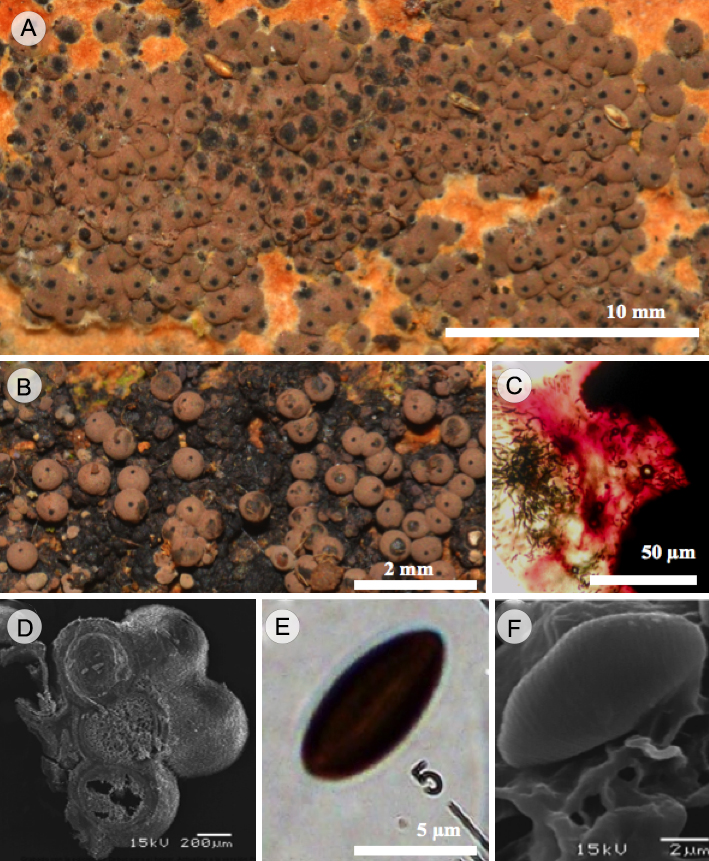 Hypoxylon lenormandii Berk. & M.A. Curtis. A. vista general del estroma glomerulado; B. vista del estroma con los peritecios conspicuos y esféricos; C. pigmentos magenta en KOH al 10%; D. peritecios esféricos vistos en MEB; E. ascospora con línea germinal sigmoide vistas en MO; F. ascospora con perisporio ligeramente estriado transversalmente vista en MEB