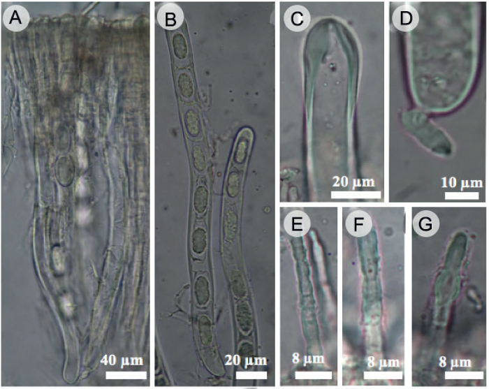 Cookeina colombiana Raymundo, Montes-Fuentes &
							R. Valenz. A. ascas y par&aacute;fisis; B. ascas uniseriadas, mostrando la capa
							gelatinosa que rodea a las ascosporas; C. subop&eacute;rculo del asca; D. base
							del asca; E-G. &aacute;pice de setas himeniales; H-J. ascosporas; K-O.
							ascosporas dentro de la capa gelatinizada.