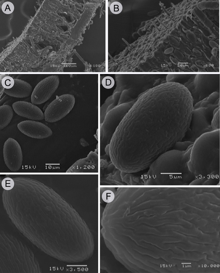 Cookeina colombiana Raymundo, Montes-Fuentes &
							R. Valenz. A. corte longitudinal del apotecio en MEB; B. superficie del
							himenio mostrando las setas himeniales que sobresalen de la superficie
							vistas en MEB; C. ascosporas en MEB; D-E. ornamentaci&oacute;n de la ascospora
							en MEB; F. detalle de la ornamentaci&oacute;n de la ascospora en MEB.