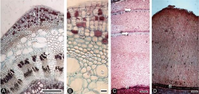 Origen y estructura del aguij&oacute;n en Ceiba Mill.,
									CTR. A-C. Ceiba aesculifolia
								(Kunth) Britten & Baker f. A. aguij&oacute;n en formaci&oacute;n; B. detalle
								de la diferenciaci&oacute;n del fel&oacute;geno, c&eacute;lulas de felema y la SR del
								c&oacute;rtex; C. aguij&oacute;n estratificado (di&aacute;metro >80 cm) con bandas
								tangenciales de c&eacute;lulas no suberificadas (flechas); D. Ceiba
									pentandra (L.) Gaertn., aguij&oacute;n homog&eacute;neo (di&aacute;metro 80
								cm). Escala=250 &micro;m en A, C, D; 25 &micro;m en B. CTR=corte transversal,
								ag=aguij&oacute;n, c=canal, fl=fel&oacute;geno, r=radio, SR=segunda regi&oacute;n,
								TR=tercera regi&oacute;n.