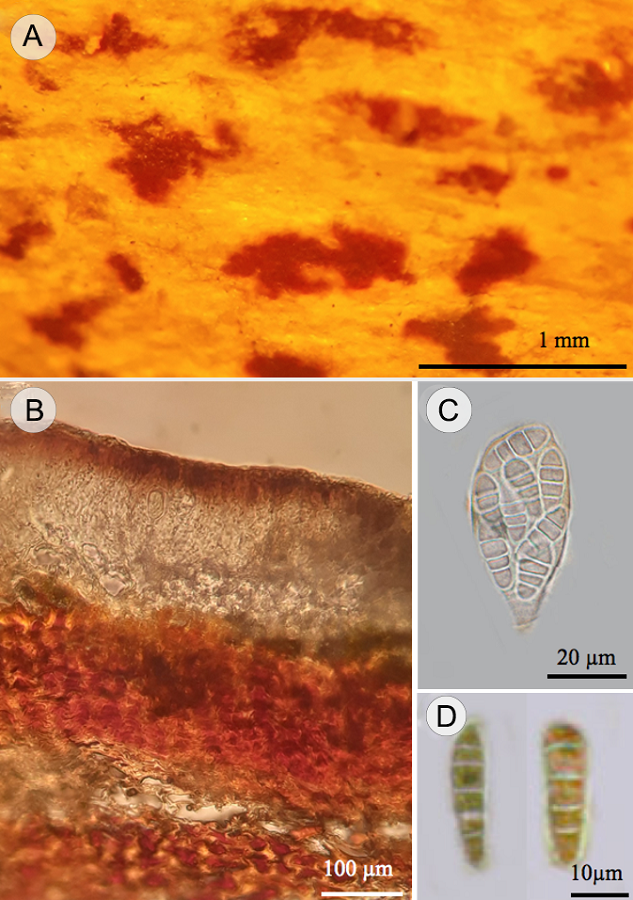Arthonia conferta (Fée) Nyl. A. ascoma; B. corte longitudinal del ascoma en sustrato; C. asca con ascosporas; D. ascosporas.
