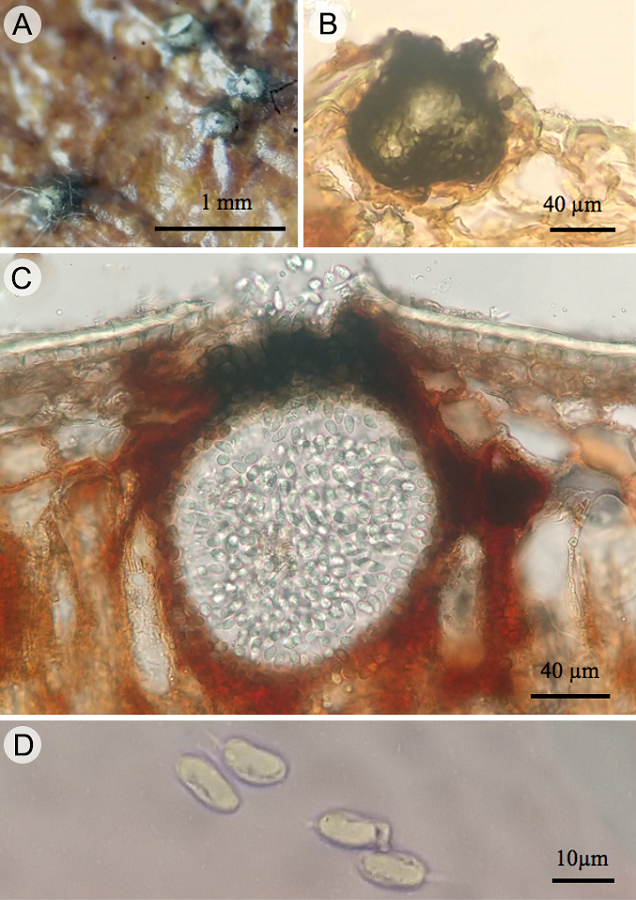 Phyllosticta capialensis Henn: A. picnidios sobre sustrato; B. vista lateral de picnidio; C. corte longitudinal de picnidio liberando conidios; D. conidios.