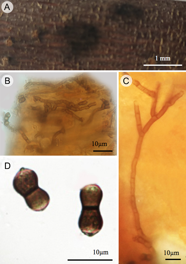 Chaetosphaerella fusca (Fuckel) E. Müll & C. Booth: A. micelio y esporas sobre raíz de R. mangle; B. hifas y conidios inmersos en el sustrato; C. conidióforo; D. conidios.