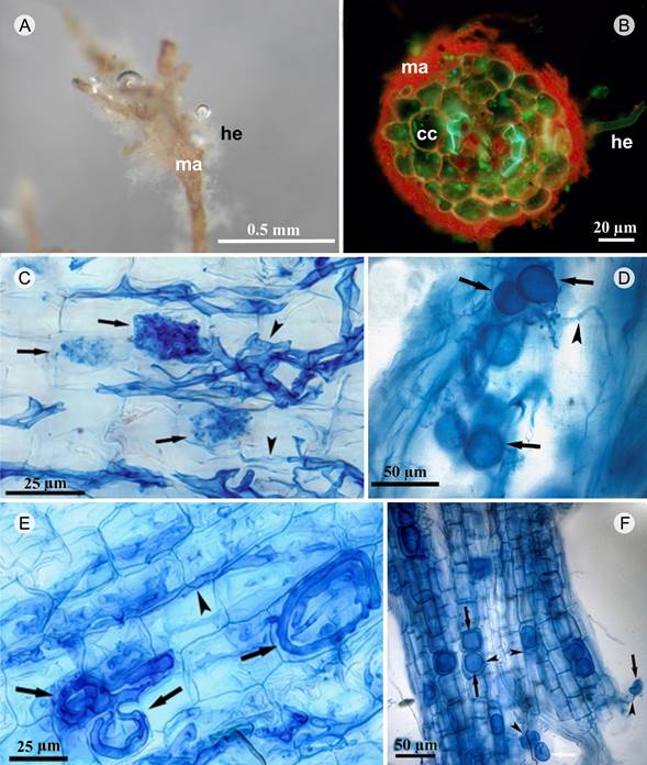 Micorrizaci&oacute;n dual de Achatocarpus spp. A. vista general de ectomicorriza donde se observa el manto evidente e hifas emanentes; B. corte transversal donde se observa el manto, hifas emanentes, c&eacute;lulas corticales de la ra&iacute;z y ausencia de red de Hartig; C. corte longitudinal de la ra&iacute;z terciaria, se observan hifas intraradicales (puntas de flecha) y arb&uacute;sculos (flechas); D. corte longitudinal de la ra&iacute;z terciaria, se observan esporas intraradicales (flechas) e hifas (punta de flecha); E. corte longitudinal de la ra&iacute;z terciaria en el que se observan ovillos (flechas) e hifas que les dan origen (punta de flecha); F. corte longitudinal de la ra&iacute;z terciaria donde se observan ves&iacute;culas intraradicales y extraradicales (flechas) e hifas que les dan origen (puntas de flecha). manto=ma, c&eacute;lulas corticales=cc, hifas emanentes=he.