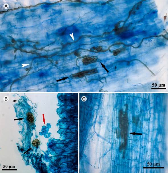 Estructuras de hongos end&oacute;fitos septados obscuros en plantas de selva baja. A. microesclerocios (flechas negras) e hifas de end&oacute;fitos septados oscuros septados (flechas blancas) en Achatocarpus sp.; B. microesclerocios (flechas negras), hifas de end&oacute;fitos septados oscuros septados (cabeza de flecha negra) y esporas de hongos micorr&iacute;zicos arbusculares (flecha roja) en Cordia L.; C. microesclerocios (flechas negras) de end&oacute;fitos septados oscuros septados en Ruprechtia sp.