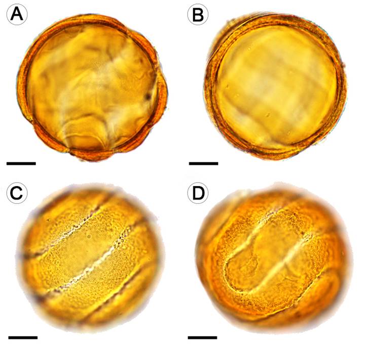 Pollen grain of Thunbergia alata Bojer ex Sims observed at 100×. A-C. equatorial view; D. polar view. A-B. structure of the cell wall. C-D. sculpture and ornamentation of the cell wall, openings (colpospiral). Scale bars = 10μm.