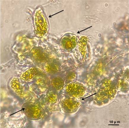 Algas unicelulares (flechas) del género Trentepohlia C. Martius, asociadas a hongos del género Glyphis Ach.