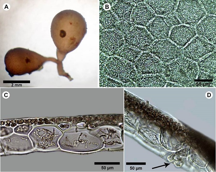 A-D. Botryocladia cf. bahamensis Ballantine & Aponte. A. habit; B. outer cortex of vesicle wall in surface view; C. cross-sections of vesicle walls; D. gland cells (arrow).