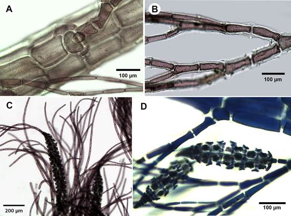 A-G. Dasya caraibica B&oslash;rgesen. A. pseudolateral filaments and cortication; B. dichotomous branching in monosiphonous branchlets, acute angle; C. tetrasporangial stichidia with apical filaments; D. stichidium with seven fertile segments and tetraspores.