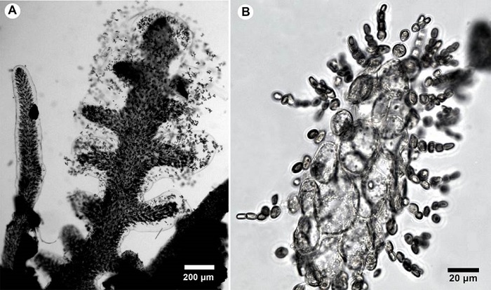 A-B. Gloioderma iyoense Okamura. A. habit. B. cross-section of the thallus.