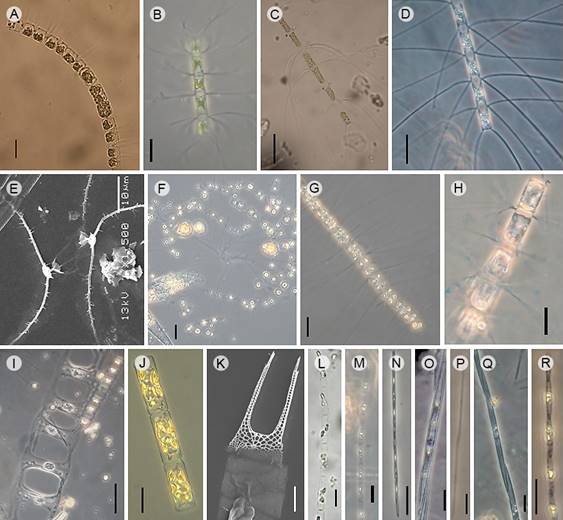 Diatom taxa that produce blooms in Acapulco, Guerrero, Mexico. A. Chaetoceros curvisetus Cleve, Light microscopy (LM); B. C. debilis Cleve (LM); C. C. laciniosus F. Schütt (LM); D. C. lorenzianus Grunow (LM); E. C. radicans F. Schütt, Scanning Electron Microscopy (SEM); F. C. socialis Lauder (LM); G. C. tortissimus Gran (LM); H. C. wighami Brightw. (LM); I. Climacodium frauenfeldianum Grunow (LM); J. Guinardia delicatula (Cleve) Hasle (LM); K. Hemiaulus hauckii Grunow ex Van Heurck (SEM); L. Leptocylindrus danicus Cleve (LM); M. L. minimus Gran (LM); N. Pseudo-nitzschia delicatissima (Cleve) Heiden (LM); O. P. pungens (Grunow ex Cleve) Hasle (LM); P. P. pseudodelicatissima (Hasle) Hasle (LM); Q. P. seriata (Cleve) H. Peragallo (LM); R. P. subfraudulenta (Hasle) Hasle (LM). Scales: A, F, G, J, N-R=20 µm; B, E, H, L, M, T=10 µm; C, D, I=50 µm; K=5 µm.