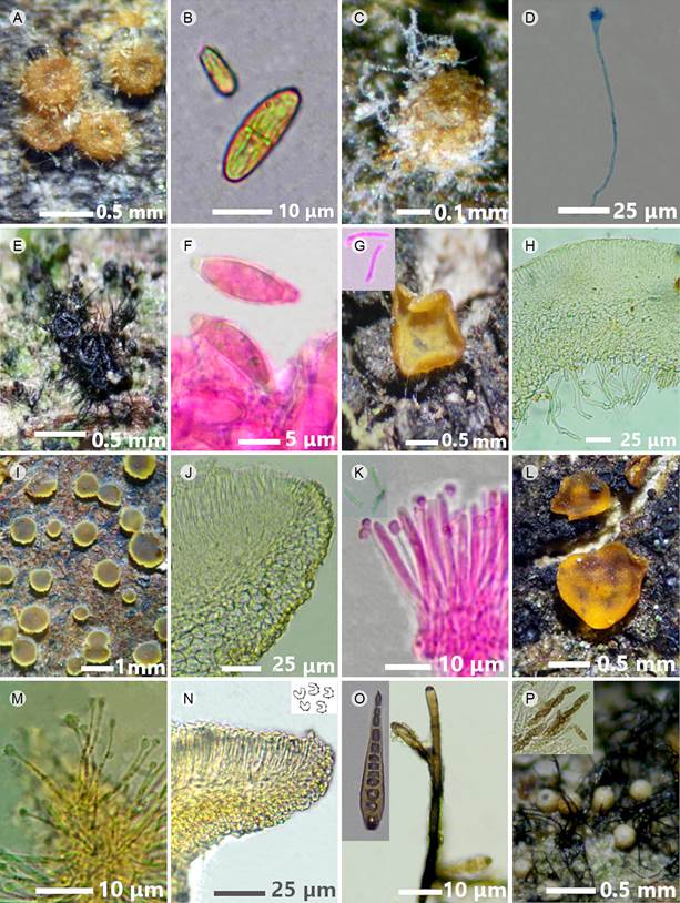 A-C. Ambarignomonia petiolorum (Schwein.)
								Sogonov: A. peritecios; B. cuello del peritecio; C. ascas con
								ascosporas; D, E. Gnomonia amoena (Nees:Fr.) Ces.
								& De Not.: D. peritecios; E. cuello del peritecio y asca; F-H.
									Belonopsis sp.: F. apotecios; G. corte
								transversal del apotecio mostrando el excípulo ectal; H. ascas y
								ascospora; I, J. Bisporella citrina (Batsch) Korf
								& S.E. Carp.: I. apotecios; J. ascas con parafisas y ascospora;
								K-M. Bisporella discedens (P. Karst.) S.E. Carp.:
								K. apotecios; L. corte transversal del apotecio mostrando el
								excípulo ectal; M. ascosporas; N-P. Bisporella
									sulfurina (Quél.) S.E. Carp.: N. apotecios; O. corte
								transversal del apotecio mostrando el excípulo ectal; P. ascas.
								Fotos: Yajaira Baeza, Rosario Medel y Elvia N. Palestina.