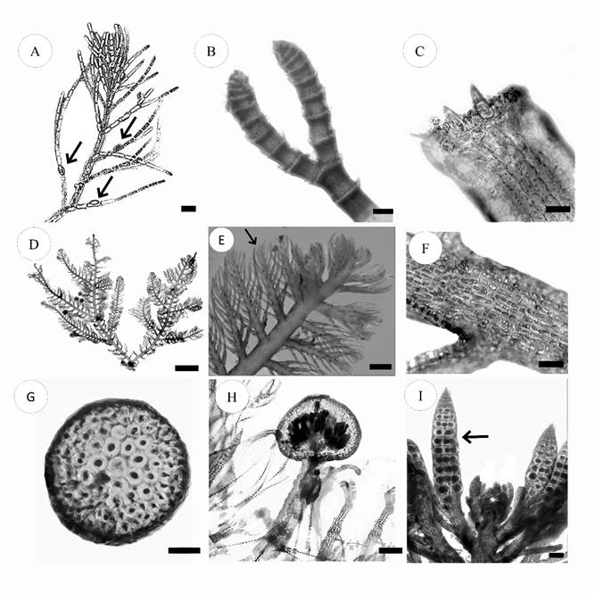 A. Antithamnionella breviramosa (E.Y. Dawson) Wollaston. A. close up of erect axis with gland cells (arrows) touching only one branch cell; B-C. Centroceras gasparrinii (Meneghini) K&uuml;tzing. B. forcipate apices; C. close-up of nodes with spines; D-I. Bostrychia tenella (J.V.Lamouroux) J.Agardh. D. habit; E. branch, showing monosiphonic branchlets (arrow); F. cortication of axes; G. transverse section of thallus; H. urn-shaped cystocarp; I. branch with stichidia (arrow). Scale bars: A=20 &micro;m, B, C=50 &micro;m, D=2 mm, E=0.25 mm, F=150 &micro;m, G=100 &micro;m, H=300 &micro;m, I=100 &micro;m.