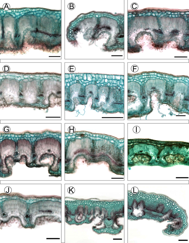 Características anatómicas de la lámina de las especies del complejo C. fothergilloides. A-B. C. fothergilloides Kunth; C-D. C. macrophyllus C.K. Schneid.; E-F. C. mojadensis C.K. Schneid.; G-H. C. pringlei (C.K. Schneid.) Rydb.; I. Cercocarpus sp. 1; J. Cercocarpus sp. 2; K-L. Cercocarpus sp. 3. Escalas: 100 μm en A-D y F-J; 200 μm en K-L.