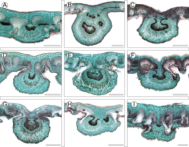 Características anatómicas de la vena media de las especies del complejo C. fothergilloides. A. C. fothergilloides Kunth; B-C. C. macrophyllus C.K. Schneid.; D-E. C. mojadensis C.K. Schneid.; F. C. pringlei (C.K. Schneid.) Rydb.; G. Cercocarpus sp. 1; H. Cercocarpus sp. 2; I. Cercocarpus sp. 3. Escalas: 300 μm en A-H y 200 μm en I.