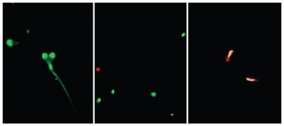 Evaluación de espermatozoides por fluorescencia. Integridad del acrosomaFITC-PNA (izquierda), Integridad estructural de membrana SYBR14/IP (medio), Potencial de membrana mitocondrial JC-1 (Derecha).