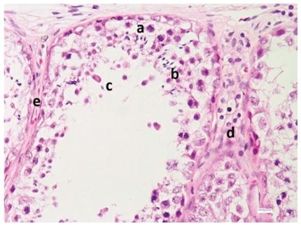 Túbulo seminífero. Espermatogonias (a), espermátides (b), espermatozoides (c), células de Leydig (d) y lámina basal (e).