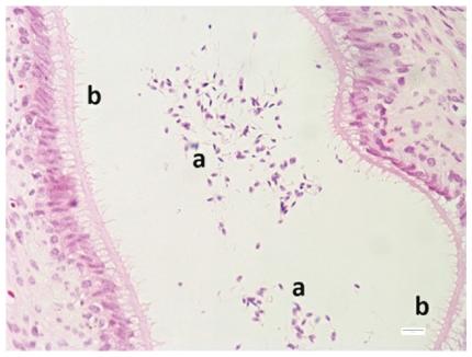 Cola del epidídimo. Espermatozoides (a), epitelio cilíndrico pseudoestratificado (b).
