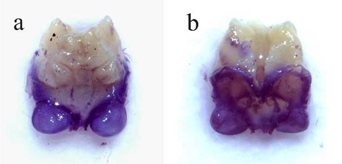 Microcentrum rhombifolium. Macho, genitalia interna: a) vista dorsal, b) vista ventral.