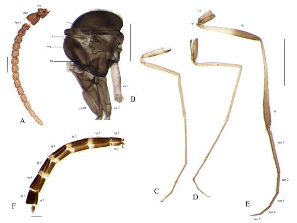 Lygistorrhina (Probolaeus) acahuizotla sp. nov. Male, Holotype. A) Antenna, lateral view; B) Thorax, lateral view; C-E) Legs, lateral view, C) Fore leg, D) Middle leg, E) Hind leg; F) Abdomen, lateral view. Scales: A = 0.1 mm; B, F = 0.5 mm; C-E = 1.0 mm.