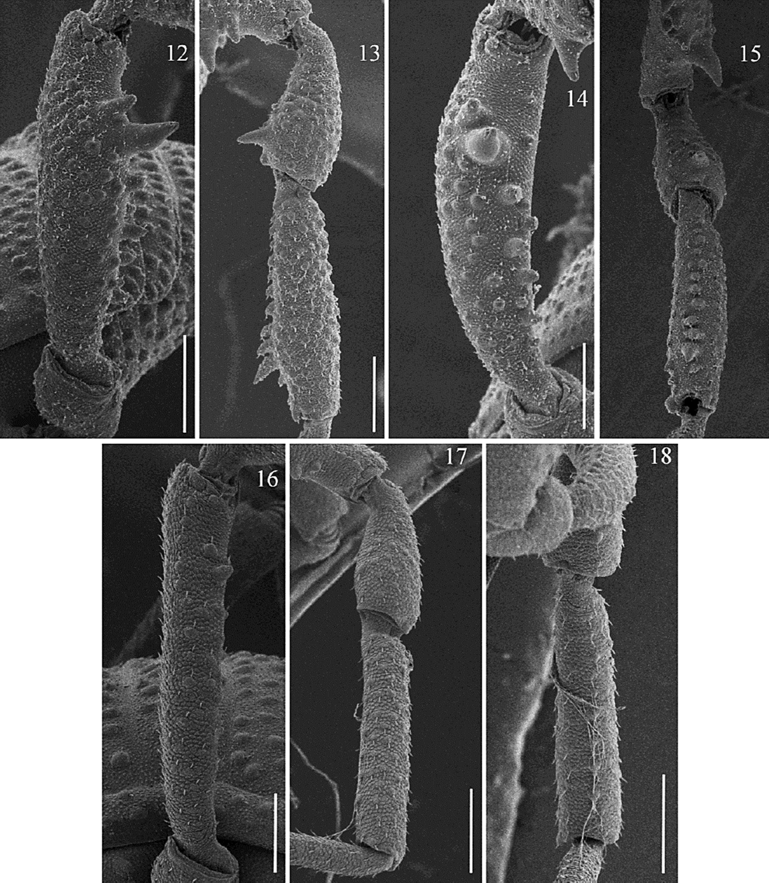 Ethobunus oaxacensis sp. nov., SEM leg IV of male
							paratype (CNAN-T01381) and female paratype (CNAN-T01381). 12) ectal
							femur male; 13) ectal patella and tibia male; 14) ventral femur male;
							15) ventral patella and tibia male; 16) ectal femur female; 17) ectal
							patella and tibia female; 18) ventral patella and tibia female. Scale
							bars: 12, 13, 15 = 250 &micro;m, 14, 17, 18 = 200 &micro;m, 16 = 150 &micro;m.