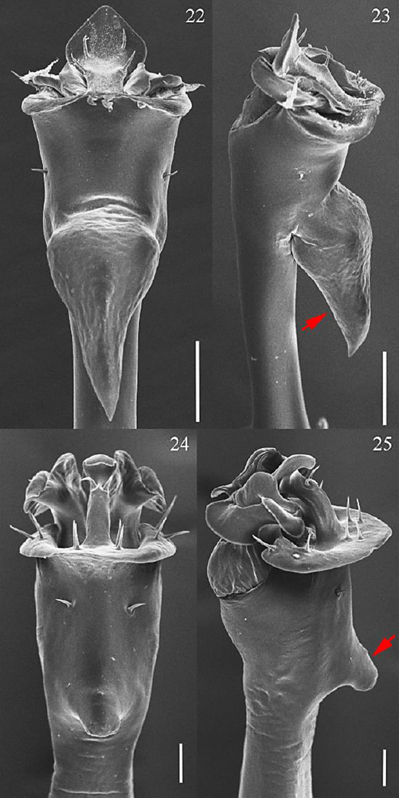 SEM Male genitalia of E. aff.
								acanthotibialis and P.
								acutus. 22) ventral E. aff.
								acanthotibialis; 23) lateral E.
							aff. acanthotibialis; 24) ventral P.
								acutus; 25) lateral P.
								acutus. Scale bars: 22, 23 = 100 &micro;m, 24, 25 = 50
							&micro;m. Read arrows indicated the ventro-basal long bulbous
							projection.