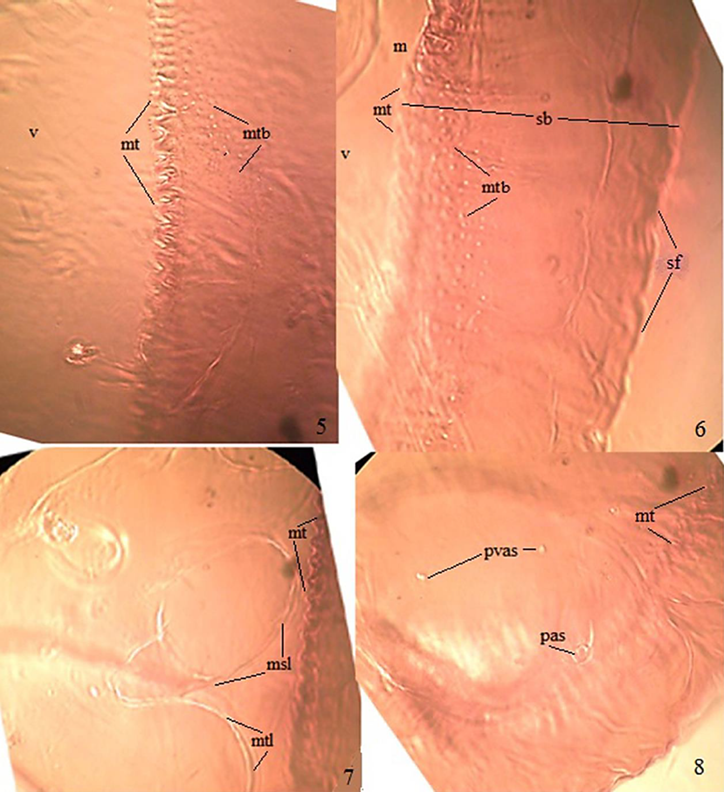Aleuropleurocelus mixtecus Carapia-Ruiz sp. nov. 5) margin and submargin; 6) submarginal band; 7) thorax (ventral view); 8) posteroventral abdominal area, msl = mosothoracic leg, mt = marginal teeth, mtb = microtubercles, mtl = metathoracic leg, pas = posteroventral abdominal spiracle, pvas = posteroventral abdominal seta, sb = submarginal band, sf = submarginal fold, v = venter.