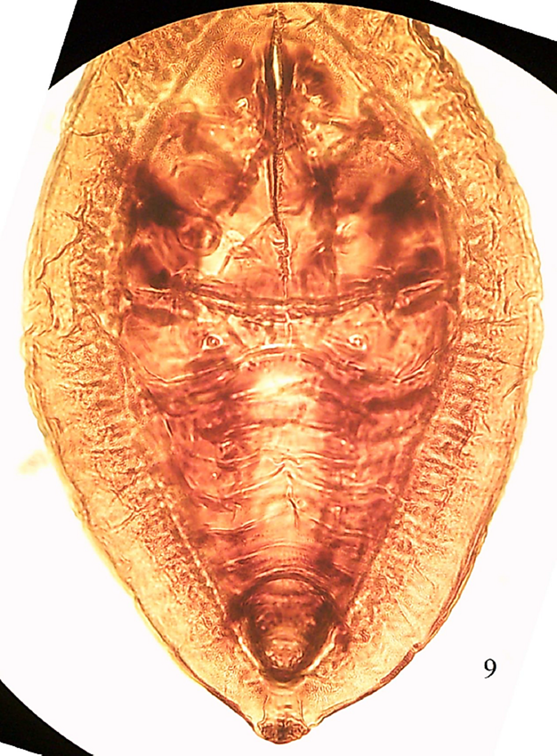 Ventral view of the puparium of Aleuropleurocelus cecropiae (Bondar).