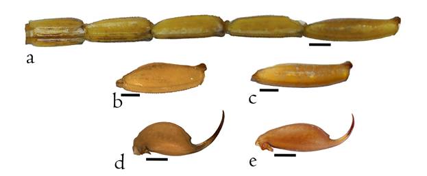 Metasoma de Centruroides baldazoi sp. nov. a) Vista lateroventral de los segmentos metasomales; b) segmento metasomal V de la hembra; c) segmento metasomal V del macho; d) ves&iacute;cula y aguij&oacute;n de la hembra; e) ves&iacute;cula y aguij&oacute;n del macho. Escala= 1.0 mm.