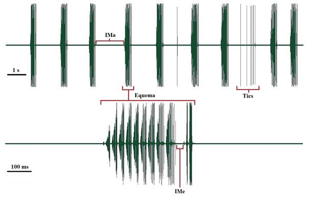 Oscilograma del canto de llamado de un macho de Obolopteryx castanea.