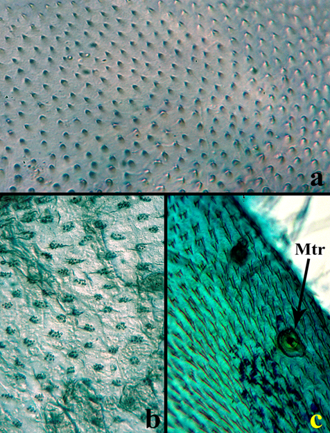 Estructuras internas en Ci. (c) carthagena. a) Tegumento &ldquo;tipo 1&rdquo;. b) Tegumento &ldquo;tipo 2&rdquo;, objetivo 20x. c) Tegumento &ldquo;tipo 3&rdquo;, objetivo 20x. Abreviaturas: Mtr= Microtriquias.
