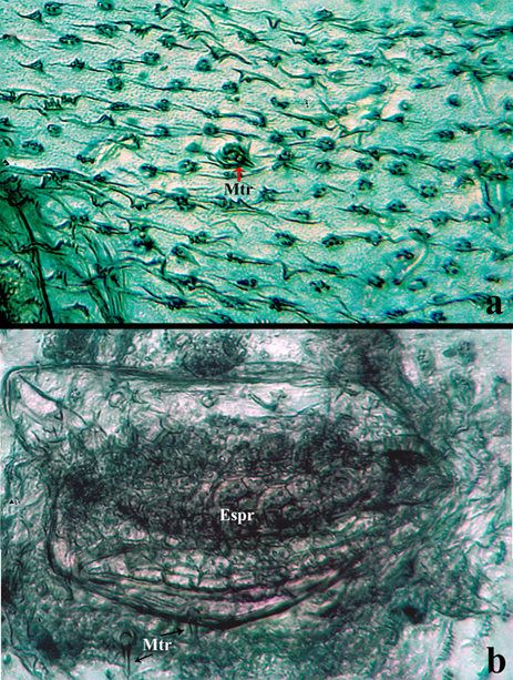 Estructuras internas en Ci. (c) carthagena. a) Tegumento tipo 2 y 3 circundantes al espir�culo, objetivo 20x. b) Espir�culo respiratorio con el tegumento aleda�o, objetivo 20x. Abreviaturas: Espr= Espir�culo respiratorio y Mtr= Microtriquias