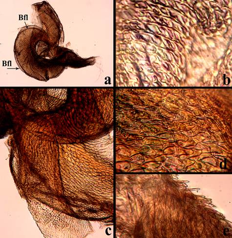 Estructuras internas en Ci. (c) carthagena. a) porci�n de las membranas que conforman las vejigas del saco interno, se aprecia un pliegue bisulcado en donde se inserta el flagelo (lo cual de acuerdo a Rivalier (1954) es caracter�stico del g�nero), objetivo 10x. b) Acercamiento a la porci�n anterior, ya observ�ndose el tegumento con m�s detalle, objetivo 20x. c) Tegumento &ldquo;tipo 6&rdquo; formado por un ret�culo diminuto en comparaci�n al placoide, Objetivo 40x. d) Tegumento placoide, compuesto de microplacas imbricadas, objetivo 40x. e) Microplacas levantadas, objetivo 40x. Abreviaturas: Bfl= Bastilla flagelar.