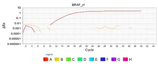 RT-PCR result showing BRAF V600E amplification in the control (Red) while the test (yellow) does not show any amplification in any of our cases.