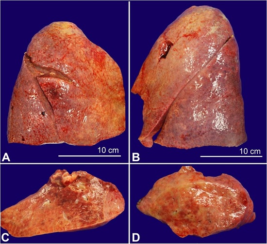 Lungs with firm overall parenchyma with multiple areas of consolidation. A &ndash; Right lung. B &ndash; Left lung. C and D &ndash; Left and right lung sections.