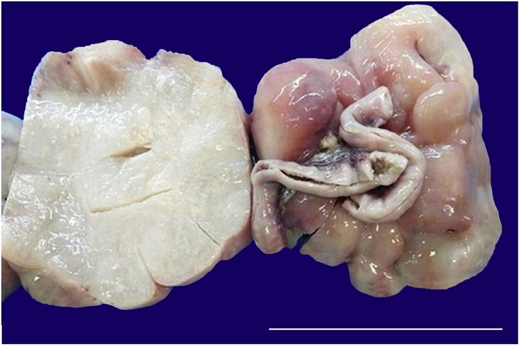 Gross examination of the tumor showing a mass with attached ileal segment and its cut surface (scale bar = 9 cm).