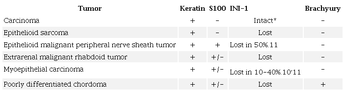 Immunohistochemical stains for the differential diagnosis of poorly differentiated chordoma