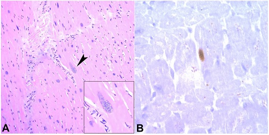 Photomicrographs of the heart showing the T. gondii cyst (arrowhead and inset) (A - H&E, 400X ; B -T.gondii stain 1000X).