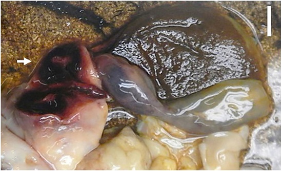 Rupture and dissection of the cystic artery. Note the soft tissue hemorrhage around the gallbladder neck (arrow). Bar: 1 cm.