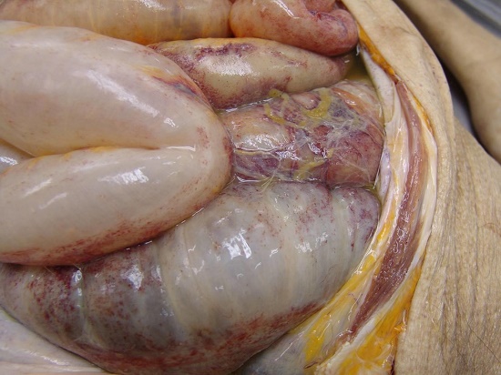 Gross aspect of abdominal cavity, showing peritoneal fibrinous exudate on the colonic surface.