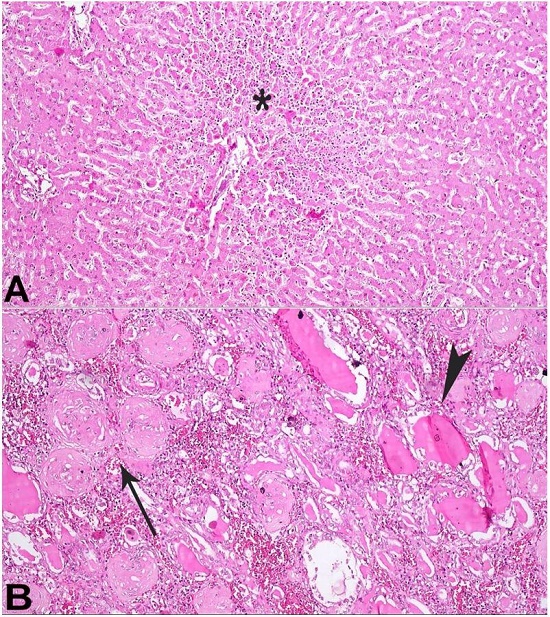 A – Photomicrograph of the liver showing centrilobular necrosis (asterisk) (H&E, 100X); B – Photomicrograph of the kidney showing glomerulosclerosis (arrow) and thyroidization of the tubules (arrowhead) (H&E, 100X).