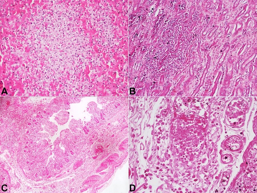 Photomicrographs of: A – the spleen showing micro abscess (H&E, 200x); B – the kidney showing foci of interstitial nephritis in the medulla (H&E, 200x); C – small intestine showing marked vascular congestion and edema in mucosa and submucosa (H&E,100x); D – arterioles of intestinal submucosa showing marked congestion with fibrin deposition along the wall indicating vascular injury (H&E, 200x).